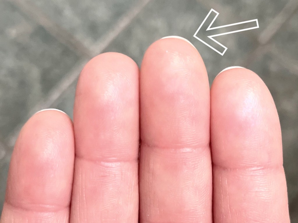 Arrow points to fingernails growing beyond the top of a finger.